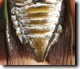 Abdomen closeup